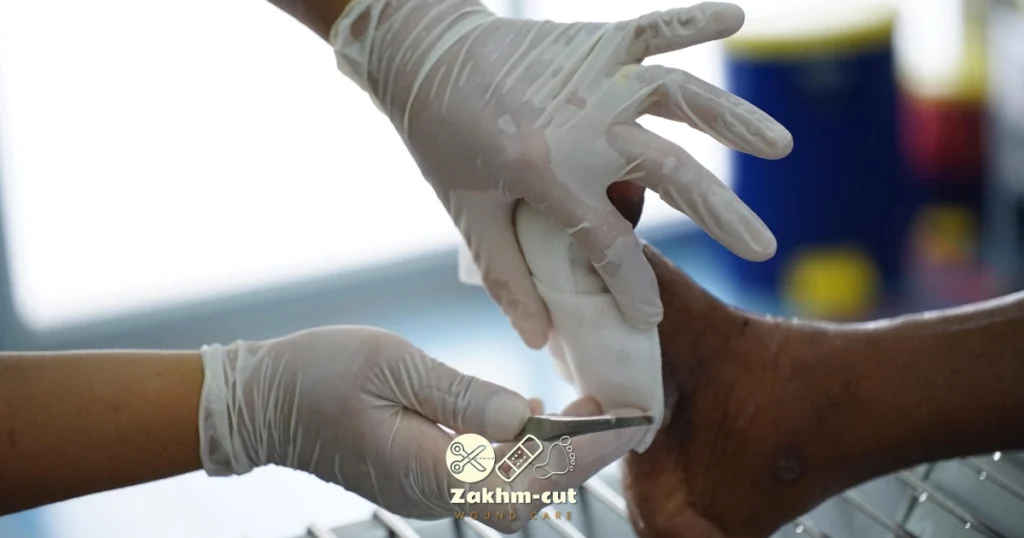 زخم پای دیابتی چیست؟