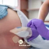 درمان زخم بستر